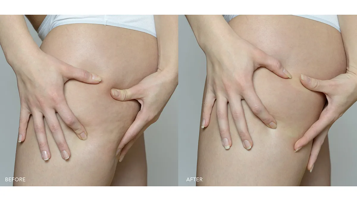 FOREO best firming body lotion